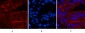 ABCB5 Monoclonal Antibody(11A2)